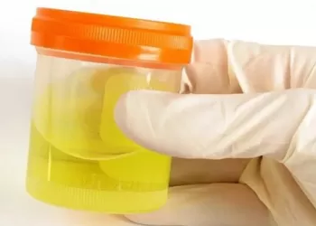 İdrar Kültürü Neden Yapılır? Sonuçları Ne Anlama Gelir?