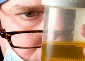 İdrar Kültürü Sonuçları Ne Zaman Çıkar?