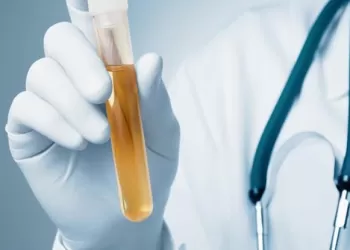 İdrar Tahlili Nasıl Yapılır?