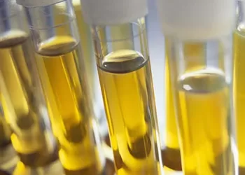 İdrar Tahlili Neyi Gösterir?