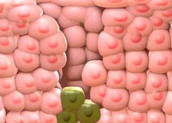 Kondilom (HPV Lezyonu) Nedir, En Etkili Tedavi Yöntemi Nedir, Ozon ile Tekrar Etmesi Nasıl Önlenir?