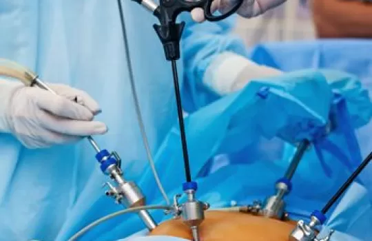 Laparoskopik Cerrahi 9 1 347x347