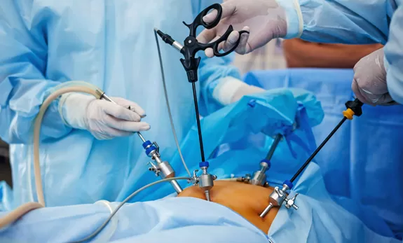 Laparoskopik Cerrahi 9