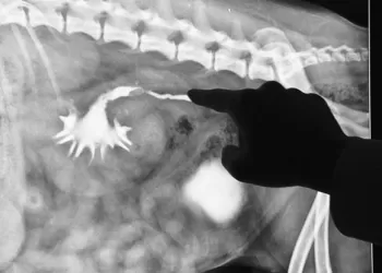 Pyelografi Nasıl Çekilir?