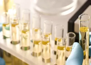 Üroflowmetri Testi Nasıl Yapılır?