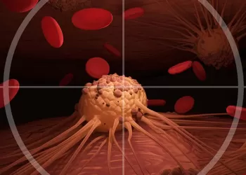 Böbrek Kanseri Tedavisinde Kemoterapi