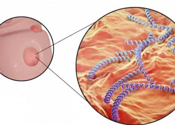 Cinsel Yolla Bulaşan Hastalıklar Nasıl Teşhis Edilir?