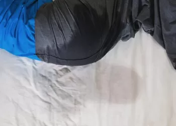 İşeme Bozuklukları Teşhisi ve Tedavisi