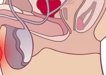 İyi Huylu Prostat Büyümesi Tedavisinde Aktif İzlem Yöntemi