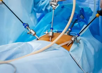 Laparoskopik Cerrahi Nasıl Yapılır?