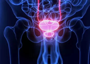 Mesane Kanseri Teşhisi