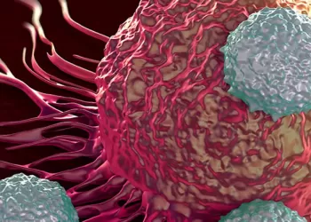 Mesane Kanserinde Radyasyon Tedavisi