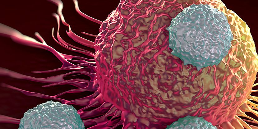 Mesane Kanserinde Radyasyon Tedavisi