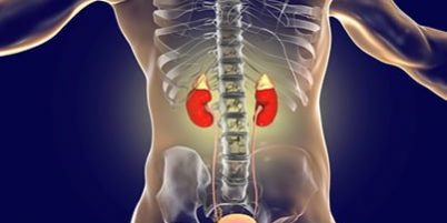 Nefroüreterektomi Tedavisi