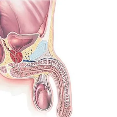 Penis Kanseri Evreleri Nelerdir?