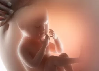 Posterior Üretral Valv Tedavisinde Vezikostomi