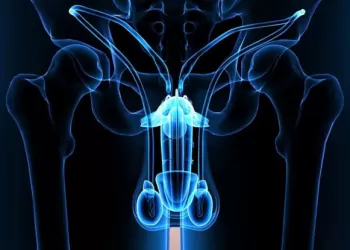 Priapizm Aspirasyon Tedavisi