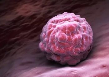 Prostat Ameliyatı Sonrası İktidarsızlık Kök Hücre İle Tedavi Edilebiliyor