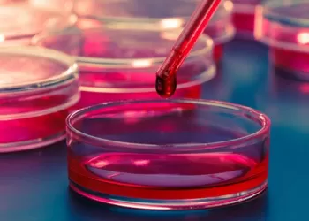 Sertleşme Sorununda Kök Hücre Tedavisi