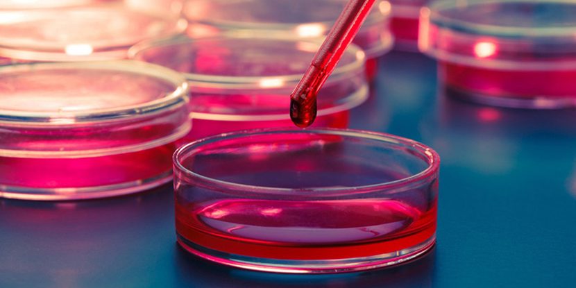 Sertleşme Sorununda Kök Hücre Tedavisi