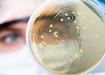 Dirençli ve Sık Tekrarlayan Sistit Hastalığında Ozon Tedavisi