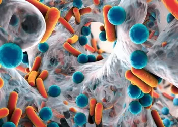 Sistit Teşhisi ve Tedavisi Nasıl Yapılır?