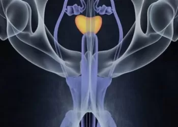 Testis Kanseri Evreleri