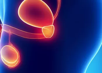 Testis Kanseri Nedenleri