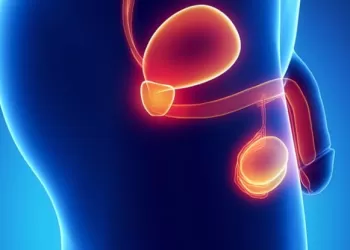 Testis Kanseri Radyoterapi Tedavi Yöntemi