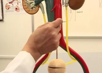 Üreter Taşı Tedavi Yöntemleri