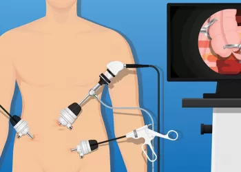 UPJ Darlığında Laparoskopik Pyeloplasti