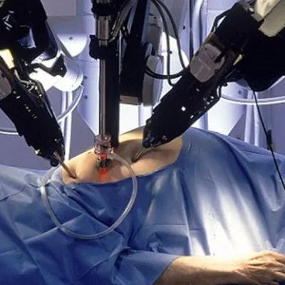 UPJ Darlığında Robotik Pyeloplasti