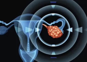 Üretra Kanseri Evreleri