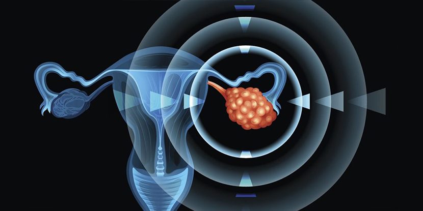 Üretra Kanseri Evreleri