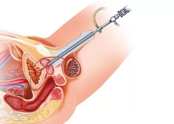 Üretra Kanseri Teşhis Yöntemleri Nelerdir?