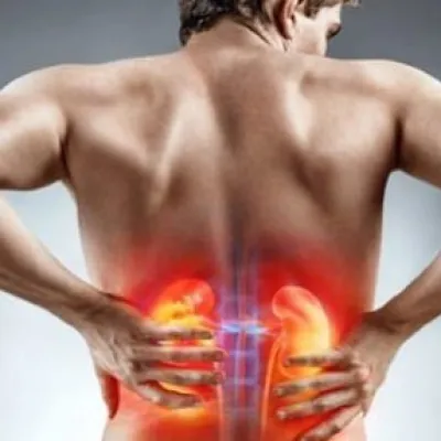 Renal Pelvis Ve Üreterin Ürotelyal Tümörleri (Üst Üriner Sistemin Üroteryal Tümörleri)