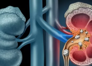 Vezikoüreteral Reflü Nedenleri