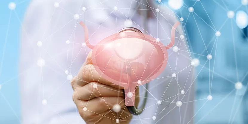 Benign Prostate Hyperplasia Bph