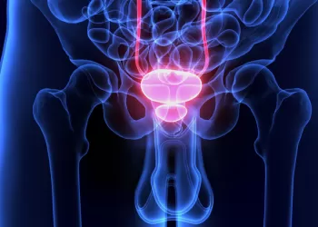 Priapizm Tedavisi Cerrahi Şant Uygulamaları