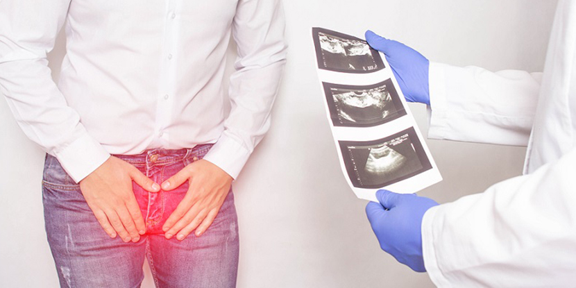 Prostat Taşı Nasıl tedavi Edilir? Şok Dalga Tedavisi (ESWT/LSWT) ve PRP Yöntemleri