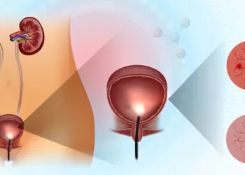 İnterstisyel Sistit İntravezikal Tedavisi