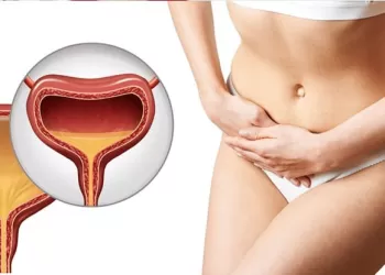 İnterstisyel Sistit (Ağrılı Mesane Sendromu) Nedir?