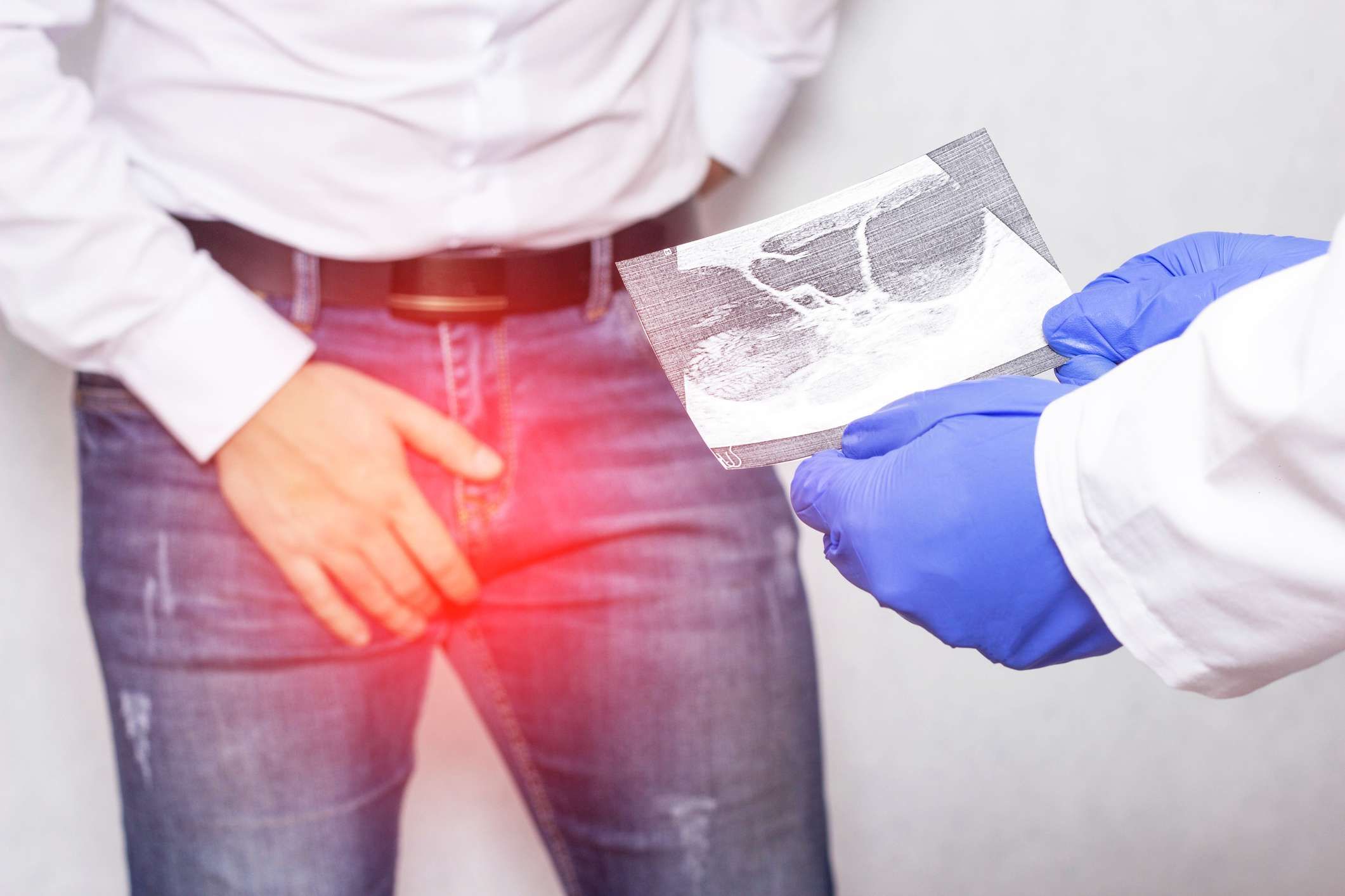 Prostatit Belirtileri ve Tedavi Yöntemleri