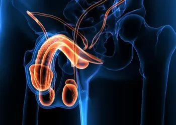 Hidrosel Ameliyatı-Hidrosel Tedavisi Cerrahi Eksizyonu (Hidroselektomi)