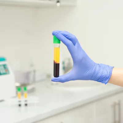 Kadınlarda Cinsel Fonksiyon Bozukluğu ve İdrar Kaçırma İçin PRP Tedavisi (O-Shot Tedavisi)