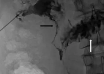 Pyelografi Nedir? Hangi Durumlarda Kullanılır?