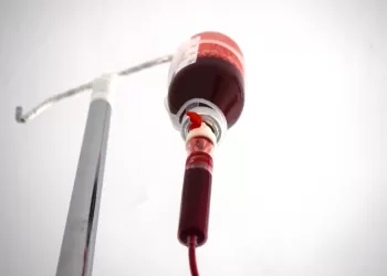 Majör Otohemoterapi Nedir? Nasıl Uygulanır?