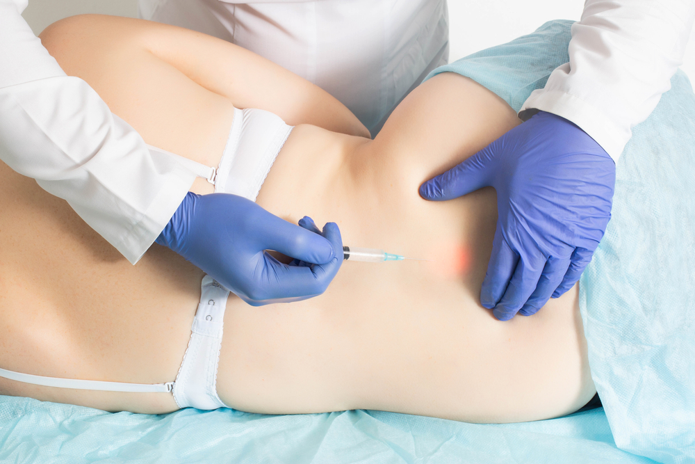 Vajinal Ozon Tedavisi Nasıl Uygulanır?