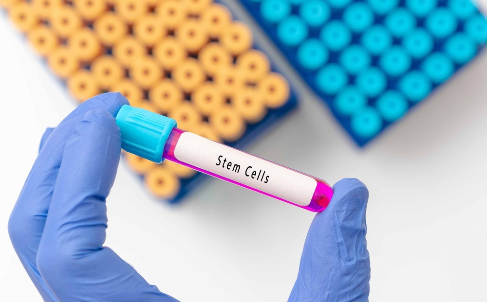 Ürolojide Kök Hücre Tedavisi: Vücudun Kendi Gücüyle İyileşme Dönemi