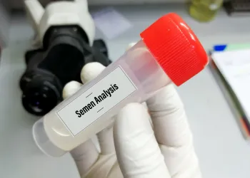 Azospermide FSH Yüksekliği Ne Anlama Gelir?